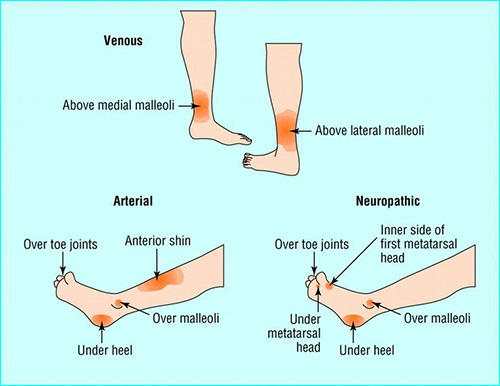 senior vascular surgeon in visakhapatnam
